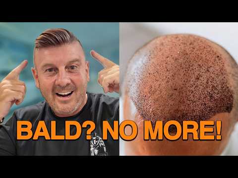 I'm having a HAIR TRANSPLANT in Pattaya? No more bald Webby!